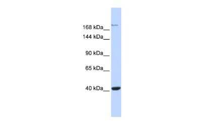 Western Blot: NMDAR2A Antibody [NBP3-10351]