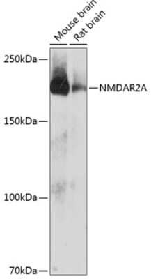 Western Blot: NMDAR2A Antibody (4U2I1) [NBP3-15657]