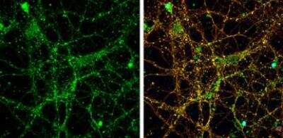 Immunocytochemistry/ Immunofluorescence: NMDAR2A Antibody [NBP2-19550]