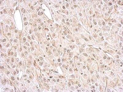 Immunohistochemistry-Paraffin: NMDAR2A Antibody [NBP2-19550]