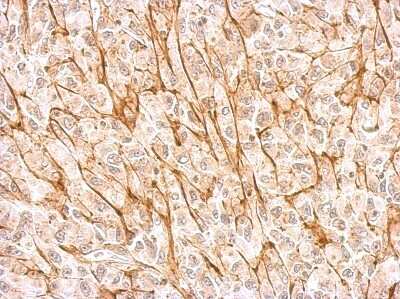 Immunohistochemistry-Paraffin: NMDAR2A Antibody [NBP2-19551]