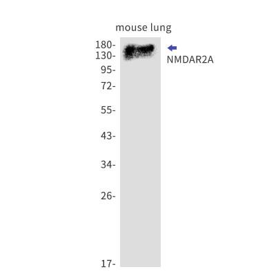 Western Blot: NMDAR2A Antibody (S03-2K3) [NBP3-19719]