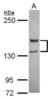 Western Blot: NMDAR2A Antibody [NBP2-19551]