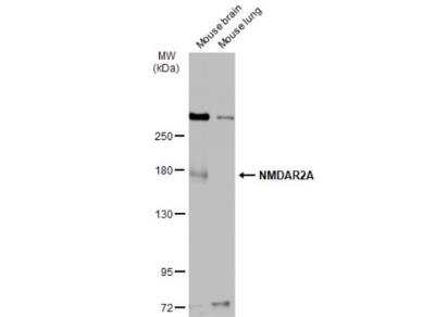 Western Blot: NMDAR2A Antibody [NBP2-19551]