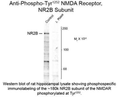 Western Blot: NMDAR2B [p Tyr1252] Antibody [NB300-292]