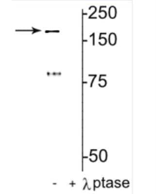 Western Blot: NMDAR2B [p Tyr1472] Antibody [NB300-182]