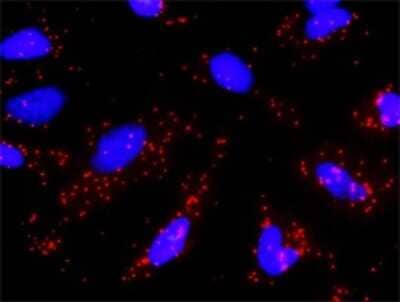 Proximity Ligation Assay: NMDAR2B Antibody (2G5) [H00002904-M01]