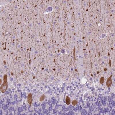 Immunohistochemistry-Paraffin: NMDAR2B Antibody [NBP2-49618]