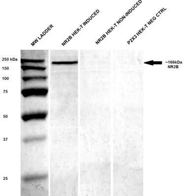 Western Blot: NMDAR2B Antibody (S59) [NBP1-47611]