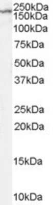 Western Blot: NMDAR2B Antibody [NB100-41097]