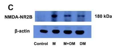 Western Blot: NMDAR2B Antibody [NB300-106]