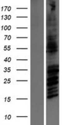 Western Blot: NMDAR2B Overexpression Lysate [NBP2-10711]