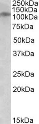 Western Blot: NMDAR3B Antibody [NBP1-52062]