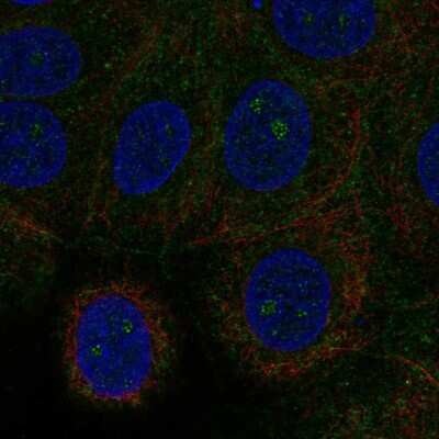 Immunocytochemistry/ Immunofluorescence: NMDARA1 Antibody [NBP1-92187]