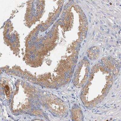 Immunohistochemistry: NMDARA1 Antibody [NBP1-89677]