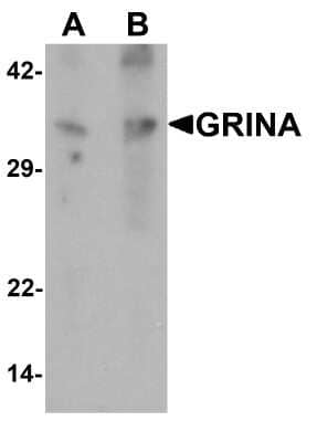 Western Blot: NMDARA1 AntibodyBSA Free [NBP2-81973]