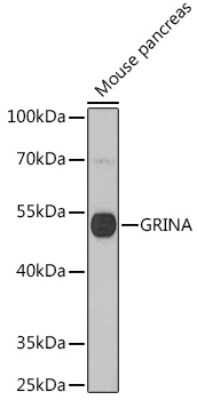 Western Blot: NMDARA1 AntibodyAzide and BSA Free [NBP2-95176]