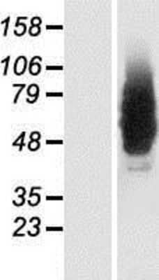 Western Blot: NMDARA1 Overexpression Lysate [NBP2-11013]