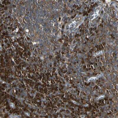 Immunohistochemistry-Paraffin: NM23-H1 Antibody [NBP1-80992]