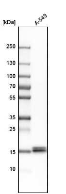 Western Blot: NM23-H1 Antibody [NBP1-80992]