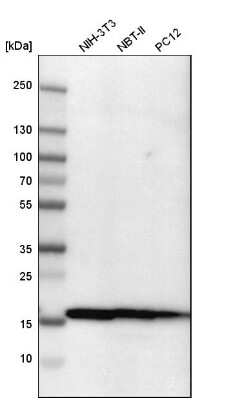 Western Blot: NM23-H1 Antibody [NBP1-80992]