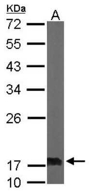 Western Blot: NM23-H2/NME2 Antibody [NBP2-19552]