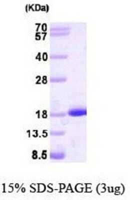 SDS-PAGE: Recombinant Human NM23-H2/NME2 Protein [NBP1-40409]