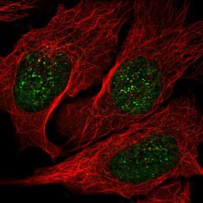 Immunocytochemistry/ Immunofluorescence: NME3 Antibody [NBP2-56908]