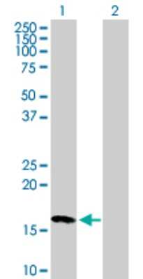 Western Blot: NME3 Antibody [H00004832-B01P]