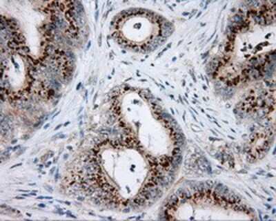 Immunohistochemistry-Paraffin: NME4 Antibody (OTI1A5) [NBP2-02487]