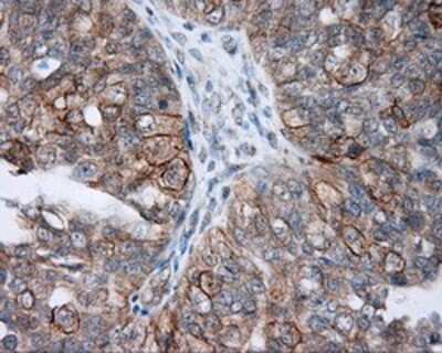 Immunohistochemistry-Paraffin: NME4 Antibody (OTI1A5) [NBP2-02487]