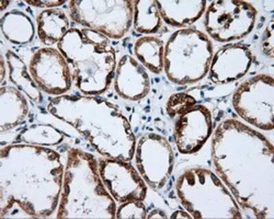 Immunohistochemistry-Paraffin: NME4 Antibody (OTI1A5) [NBP2-02487]