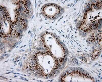 Immunohistochemistry: NME4 Antibody (OTI1A5) - Azide and BSA Free [NBP2-73005]