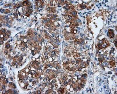 Immunohistochemistry: NME4 Antibody (OTI1A5) - Azide and BSA Free [NBP2-73005]