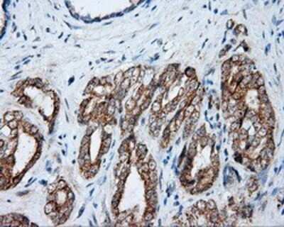 Immunohistochemistry: NME4 Antibody (OTI1A5) - Azide and BSA Free [NBP2-73005]