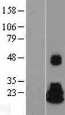 Western Blot: NME4 Overexpression Lysate [NBL1-13686]