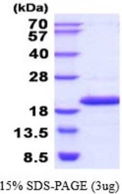 SDS-PAGE: Recombinant Human NME4 His Protein [NBP2-52254]