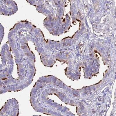 Immunohistochemistry-Paraffin: NME5 Antibody [NBP1-92188]
