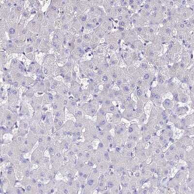 Immunohistochemistry-Paraffin: NME5 Antibody [NBP1-92188]