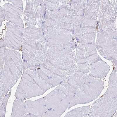 Immunohistochemistry-Paraffin: NME5 Antibody [NBP1-92188]