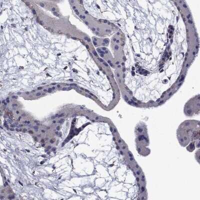 Immunohistochemistry-Paraffin: NME5 Antibody [NBP3-17061]