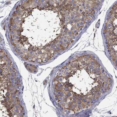 Immunohistochemistry-Paraffin: NME5 Antibody [NBP3-17061]