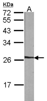 Western Blot: NME5 Antibody [NBP1-32207]