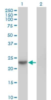 Western Blot: NME6 Antibody (2A10) [H00010201-M07]