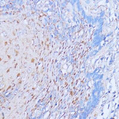 Immunohistochemistry-Paraffin: NME6 Antibody - Azide and BSA Free [NBP2-93423]