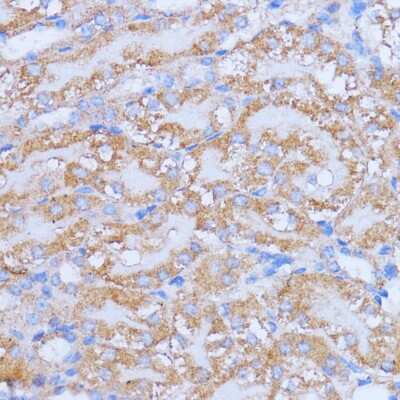 Immunohistochemistry-Paraffin: NME6 Antibody - Azide and BSA Free [NBP2-93423]