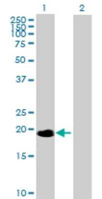 Western Blot: NME6 Antibody [H00010201-B02P]