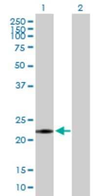 Western Blot: NME6 Antibody [H00010201-B03P]