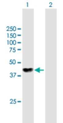 Western Blot: NME7 Antibody [H00029922-B01P]