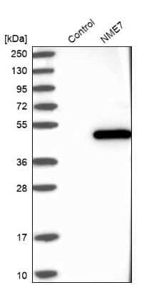 Western Blot: NME7 Antibody [NBP1-83482]